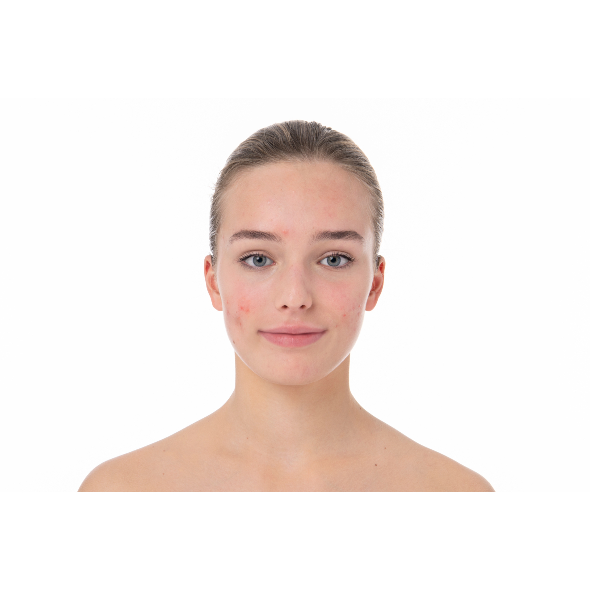 AKN Mat SPF30 - Instruction for use