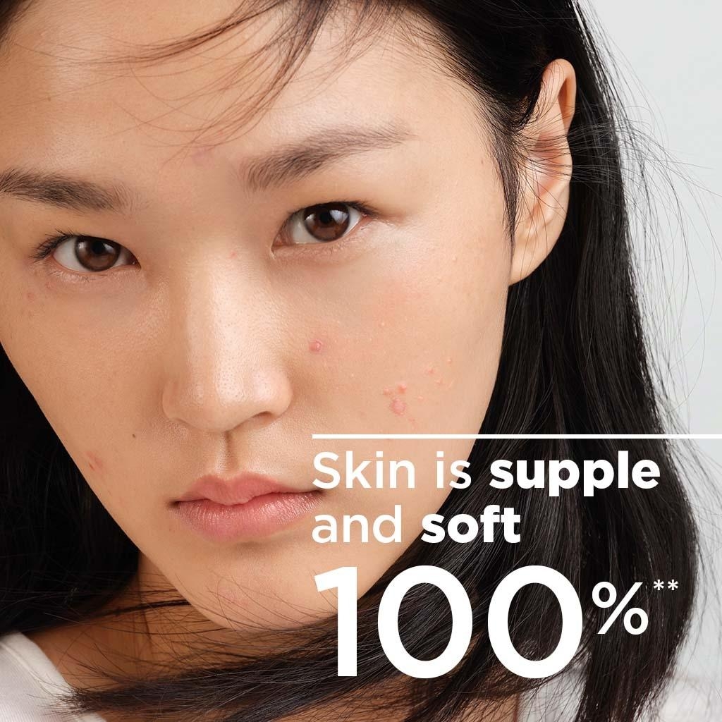 Under & Post Acne Treatment Set - Proof of efficacy/Benefits/Still lives